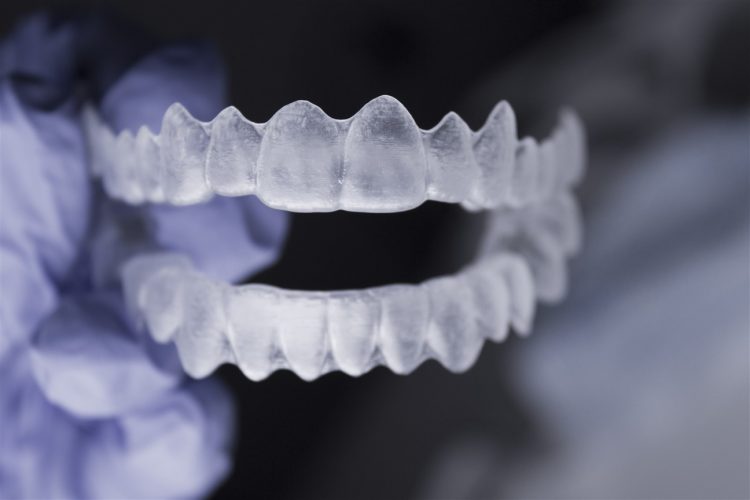 Invisalign Edmonton